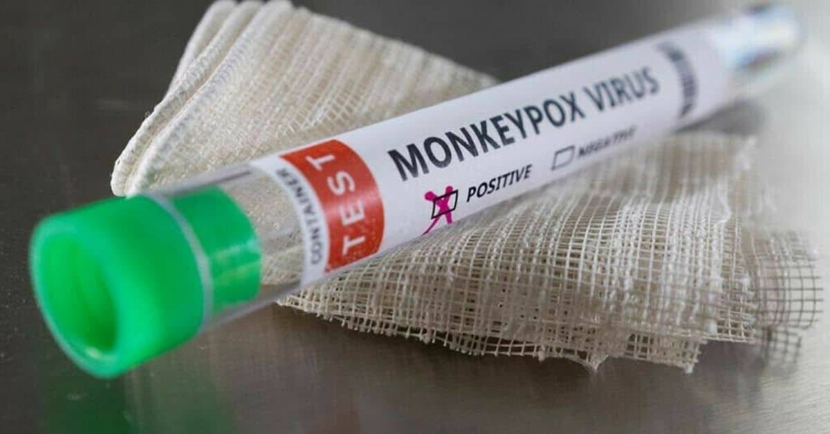 Another monkeypox case reported in Karachi