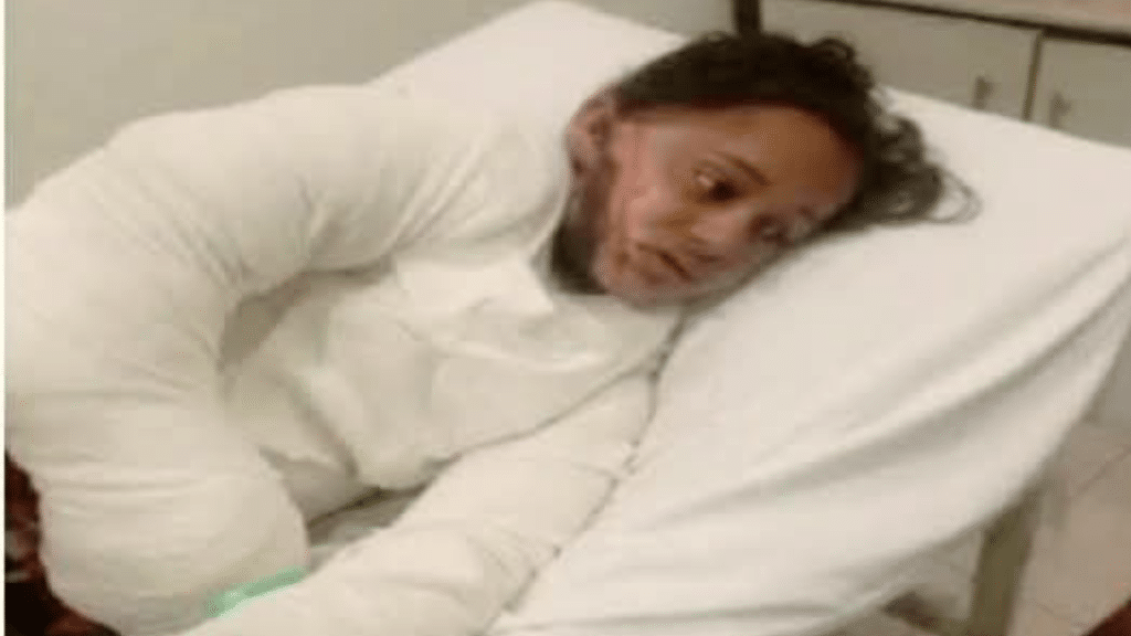 Young student loses arms to electrocution