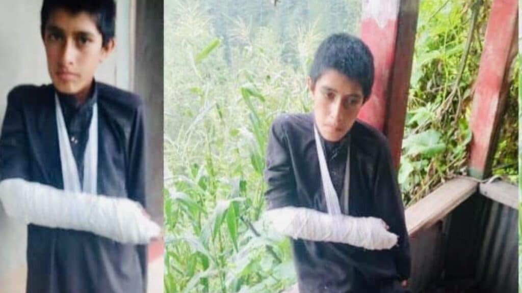 Minor boy brutally tortured in AJK for picking fruits, incident sparks public outrage