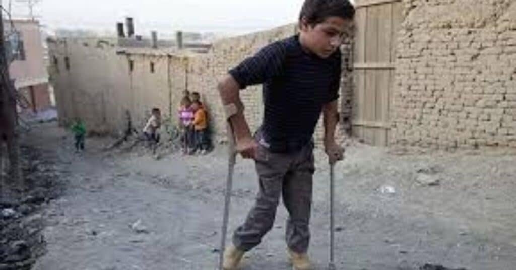 polio