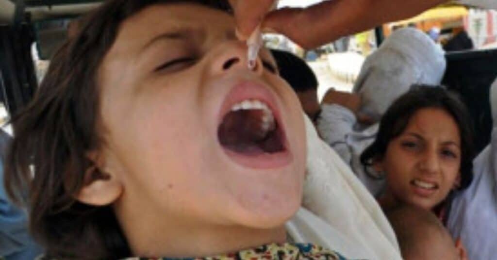 polio