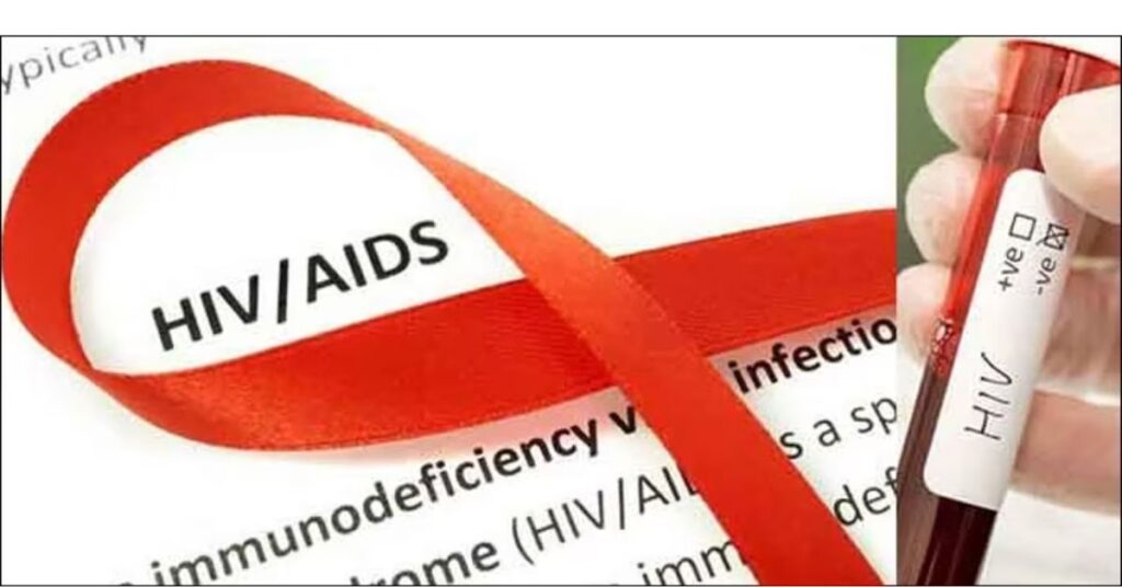 hiv
