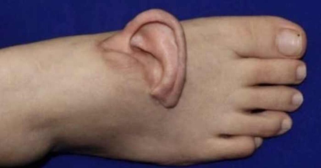 ear