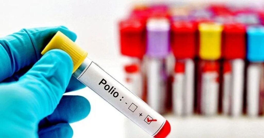 Polio detected in 40 samples nationwide