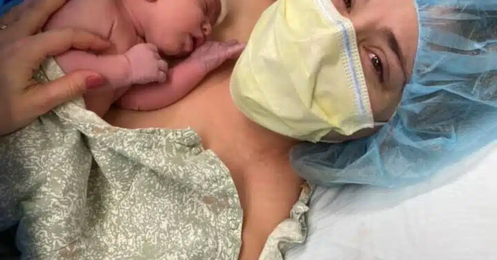 c-section