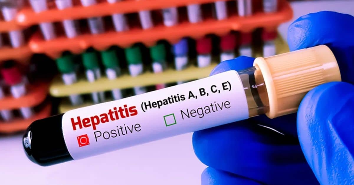 Hepatitis test now mandatory for federal govt employees