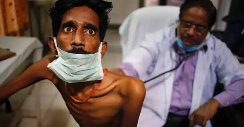 Pakistan has 3,900 AIDS patients, 417,214 living with HIV